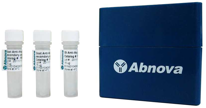 1646126212265873.jpg Abnova.jpg